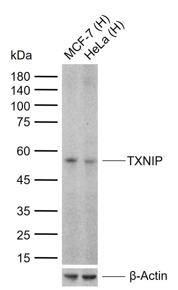 硫氧还蛋白结合蛋白2重组兔单抗