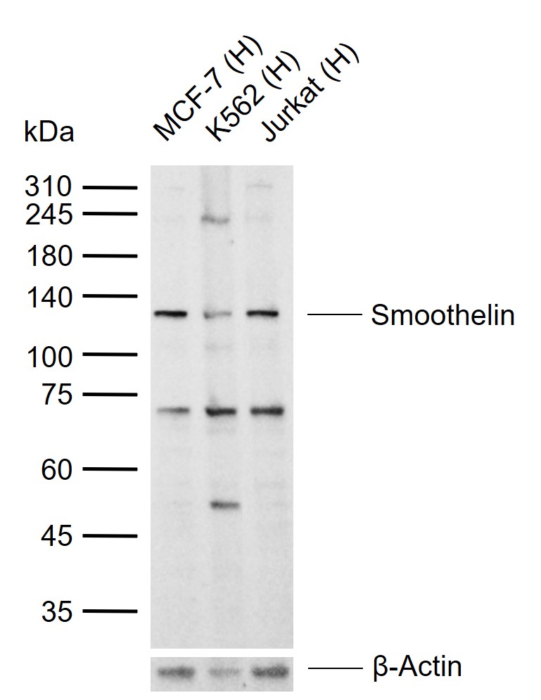 Smoothelin Rabbit pAb (一抗) - WB,IHC-P,IHC-F,IF | Bioss