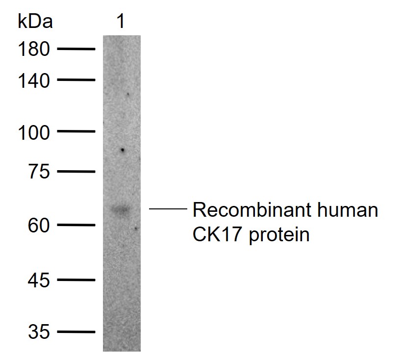 CK17 Rabbit pAb (一抗) | Bioss