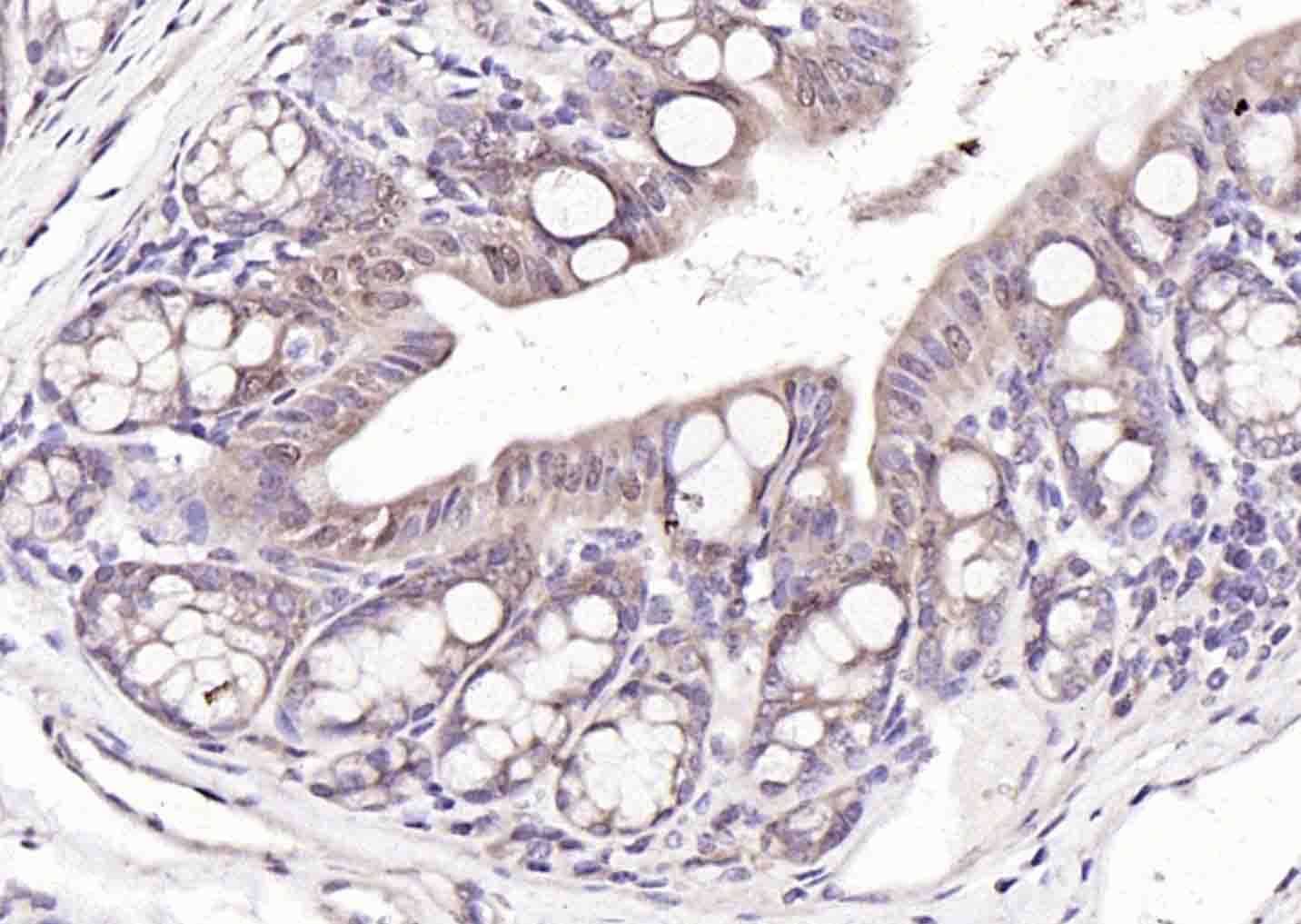 NAT10 Rabbit pAb (一抗) | Bioss