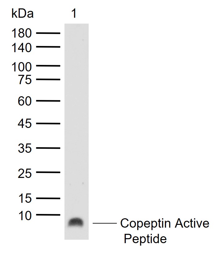 Copeptin Rabbit pAb (一抗) | Bioss