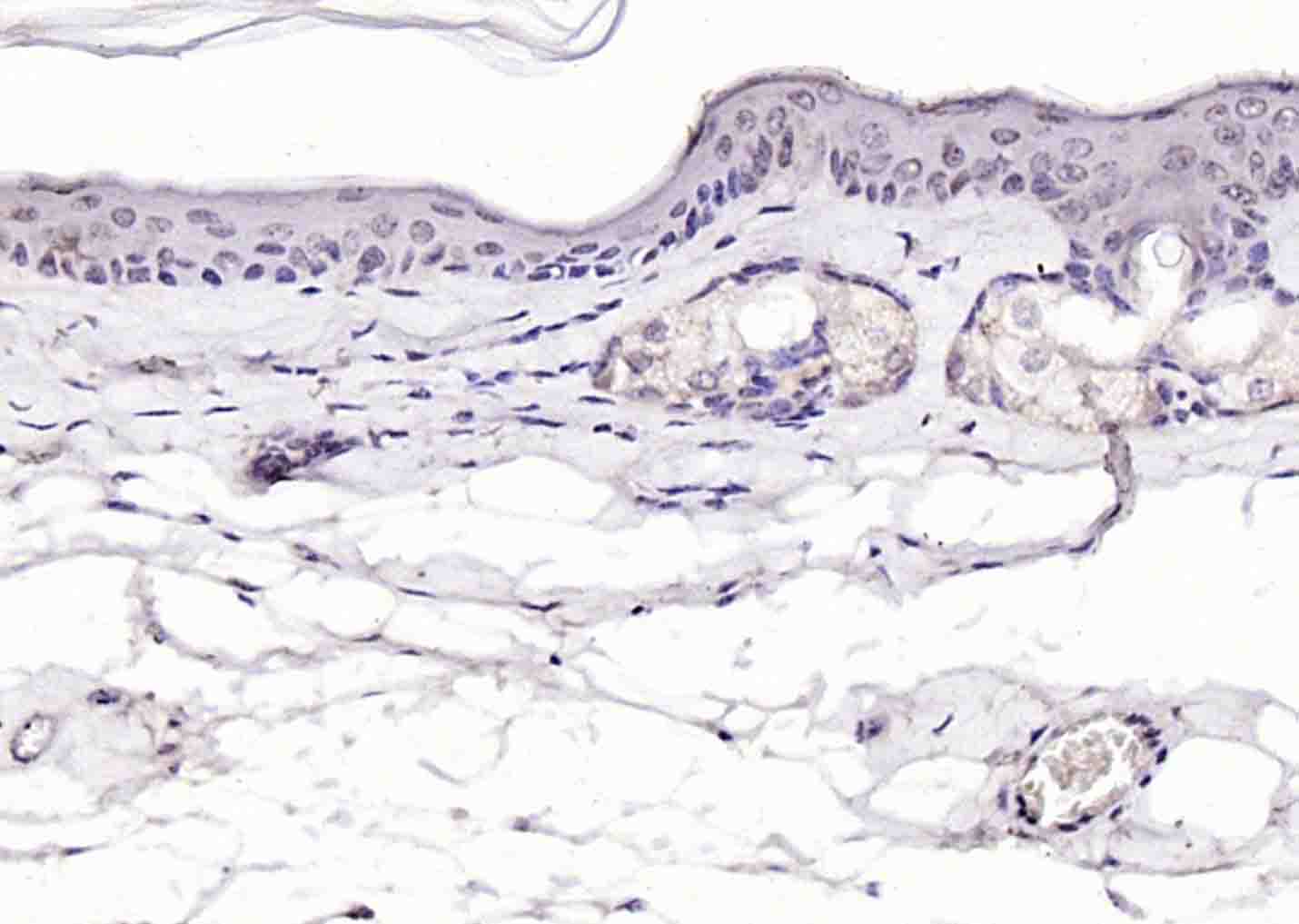 磷酸化细胞肿瘤抗原P53抗体-bs-1650R
