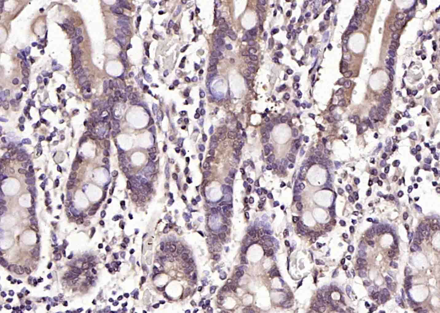 热休克蛋白71单克隆抗体-bsm-33211M