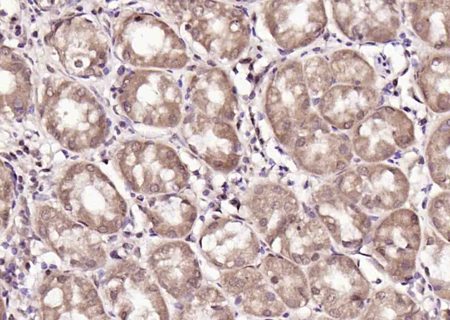 热休克蛋白71单克隆抗体-bsm-33211M