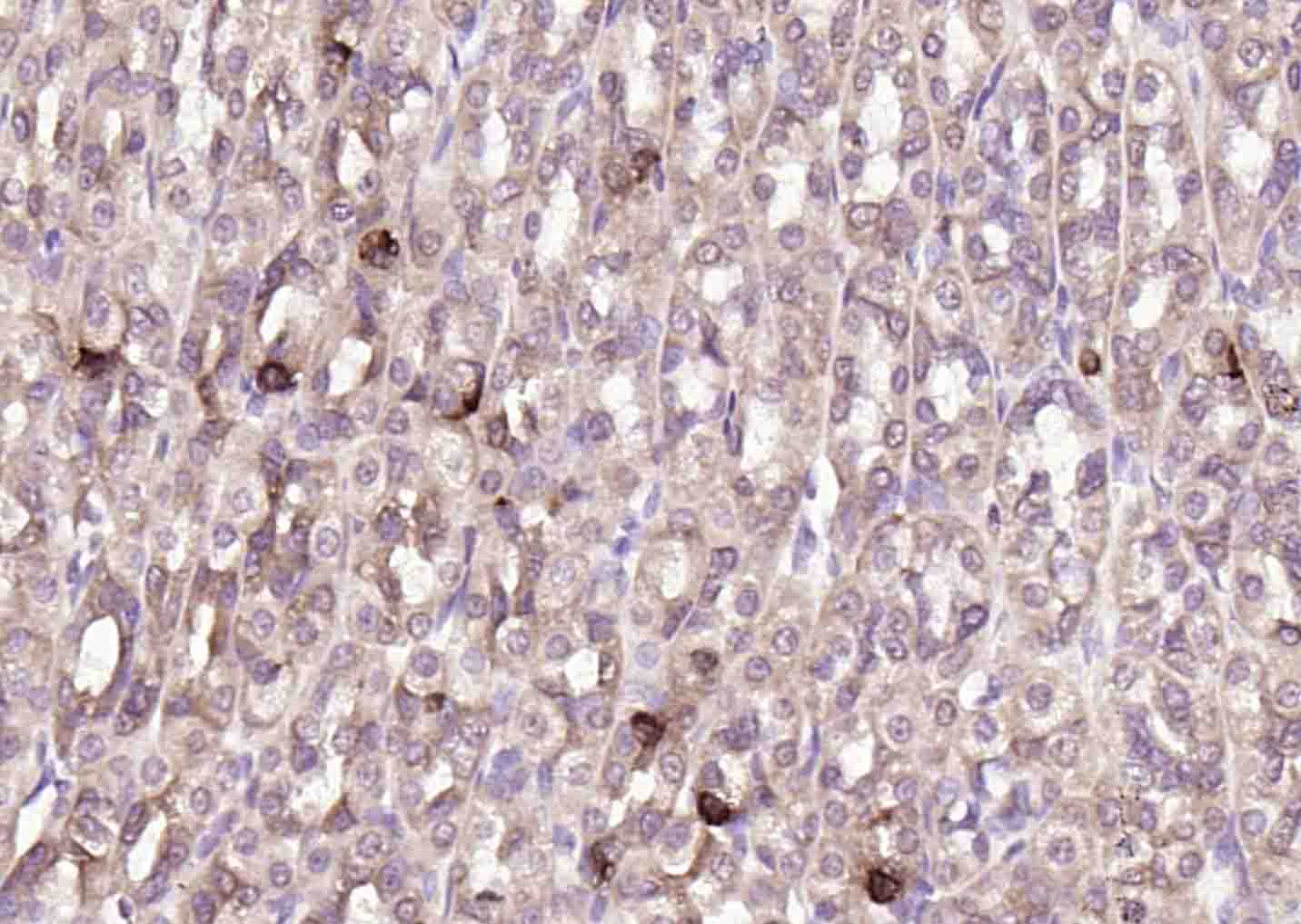 热休克蛋白71单克隆抗体-bsm-33211M