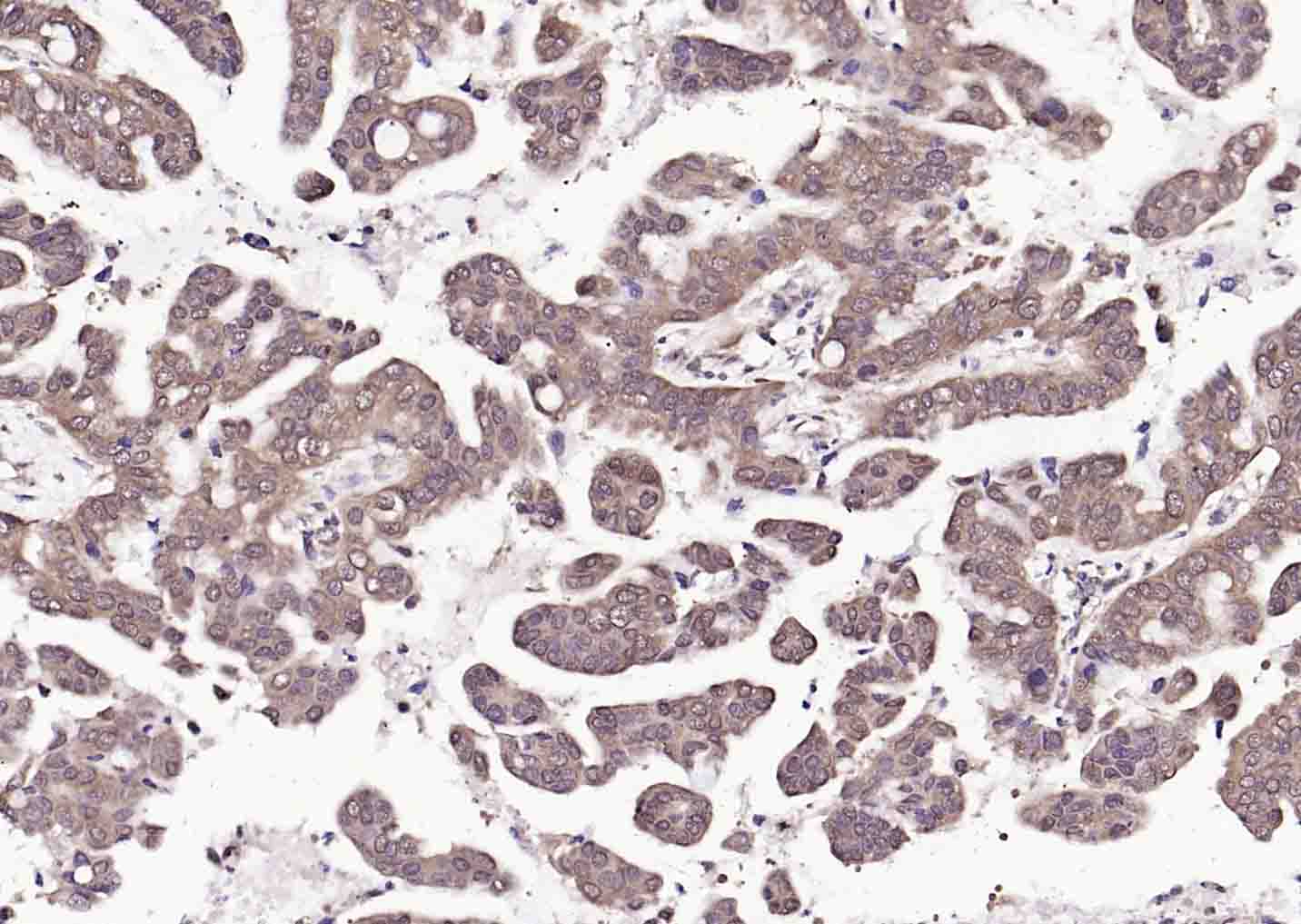 热休克蛋白71单克隆抗体-bsm-33211M