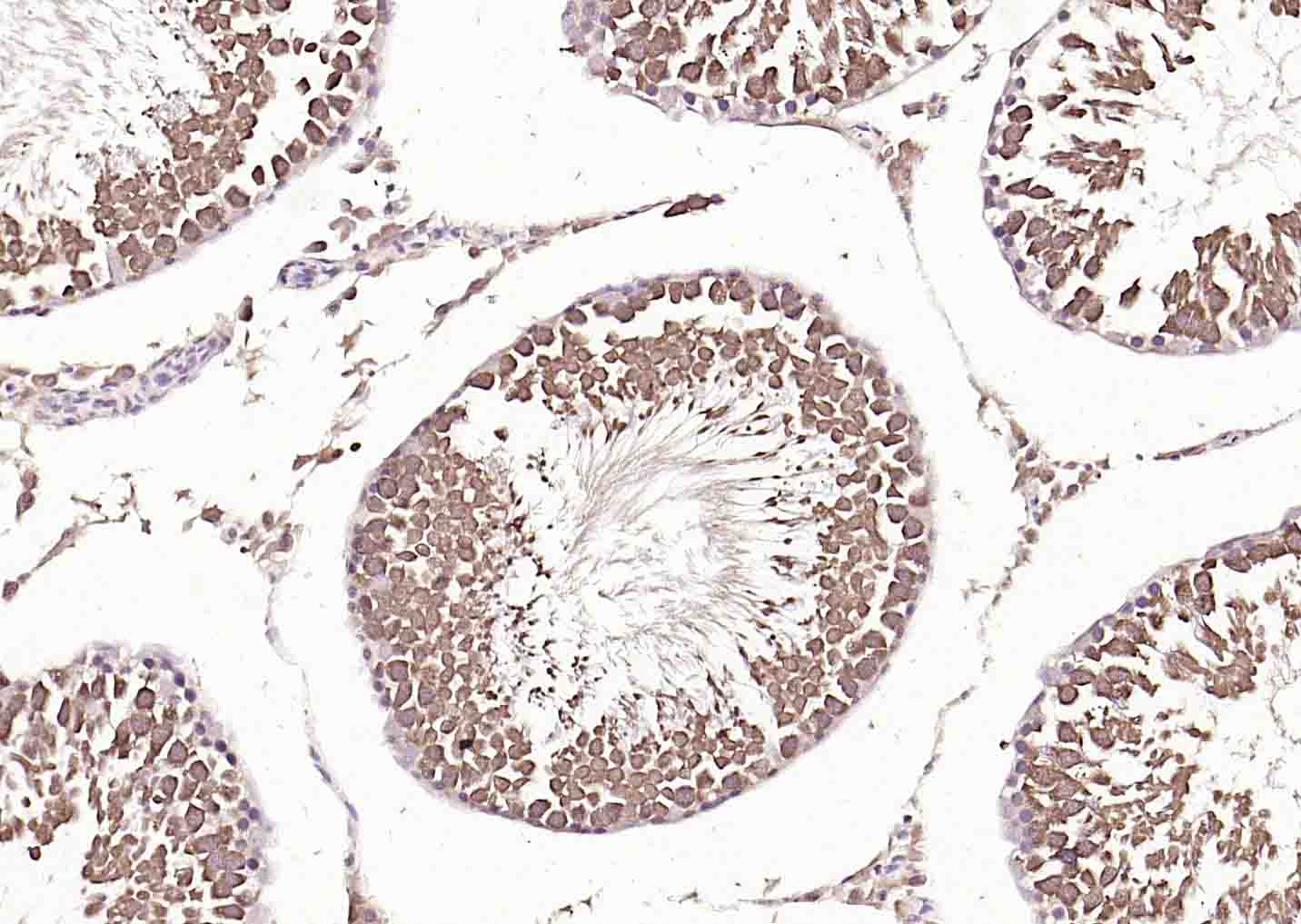 热休克蛋白71单克隆抗体-bsm-33211M