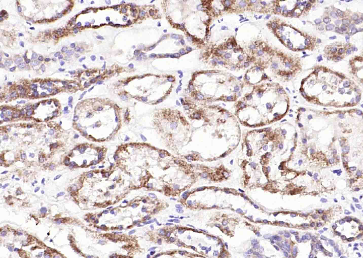 溶质载体家族蛋白39成员A14抗体-bs-19829R
