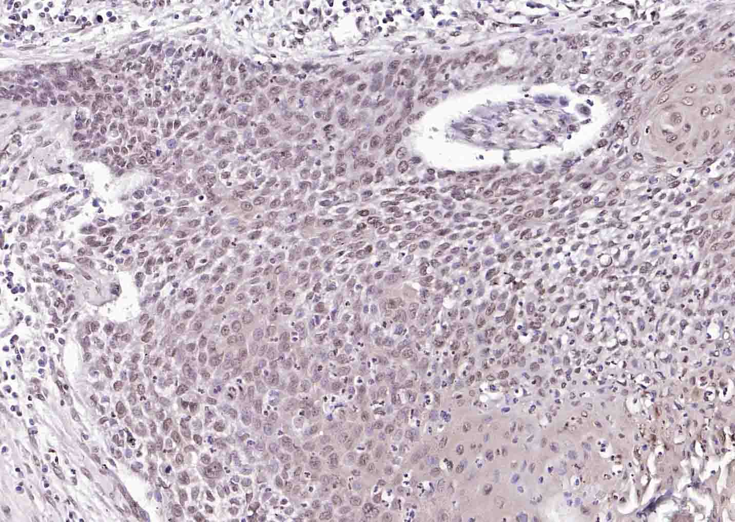 phospho-SRF (Ser77) Rabbit pAb (一抗) | Bioss