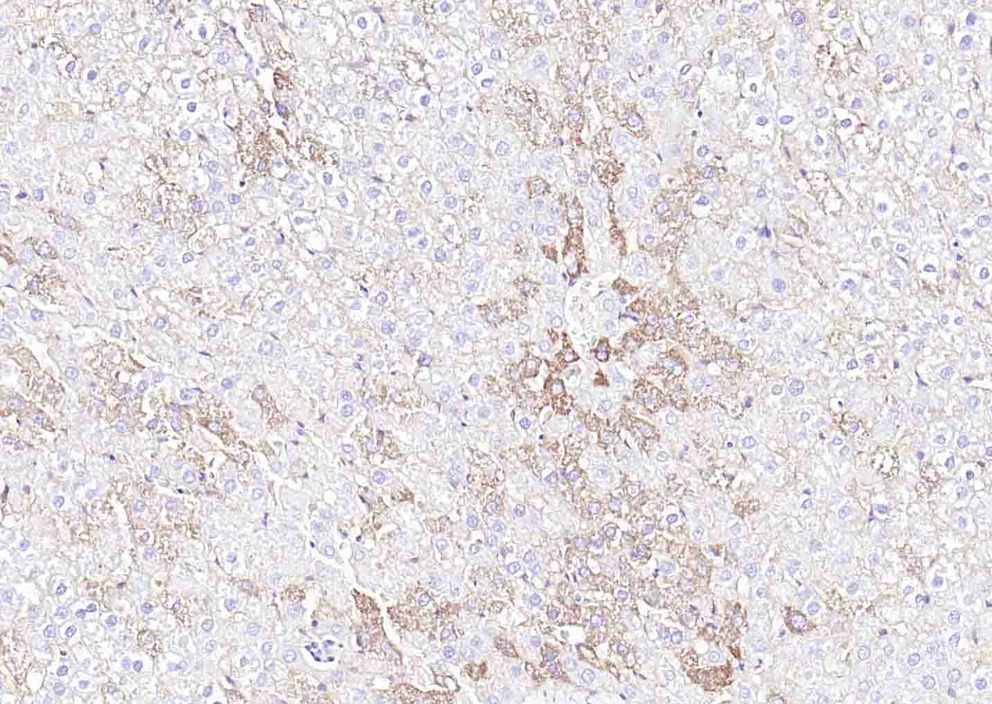 SLC39A14 Rabbit pAb (一抗) - IHC-P,IHC-F,IF,ICC/IF,ELISA | Bioss