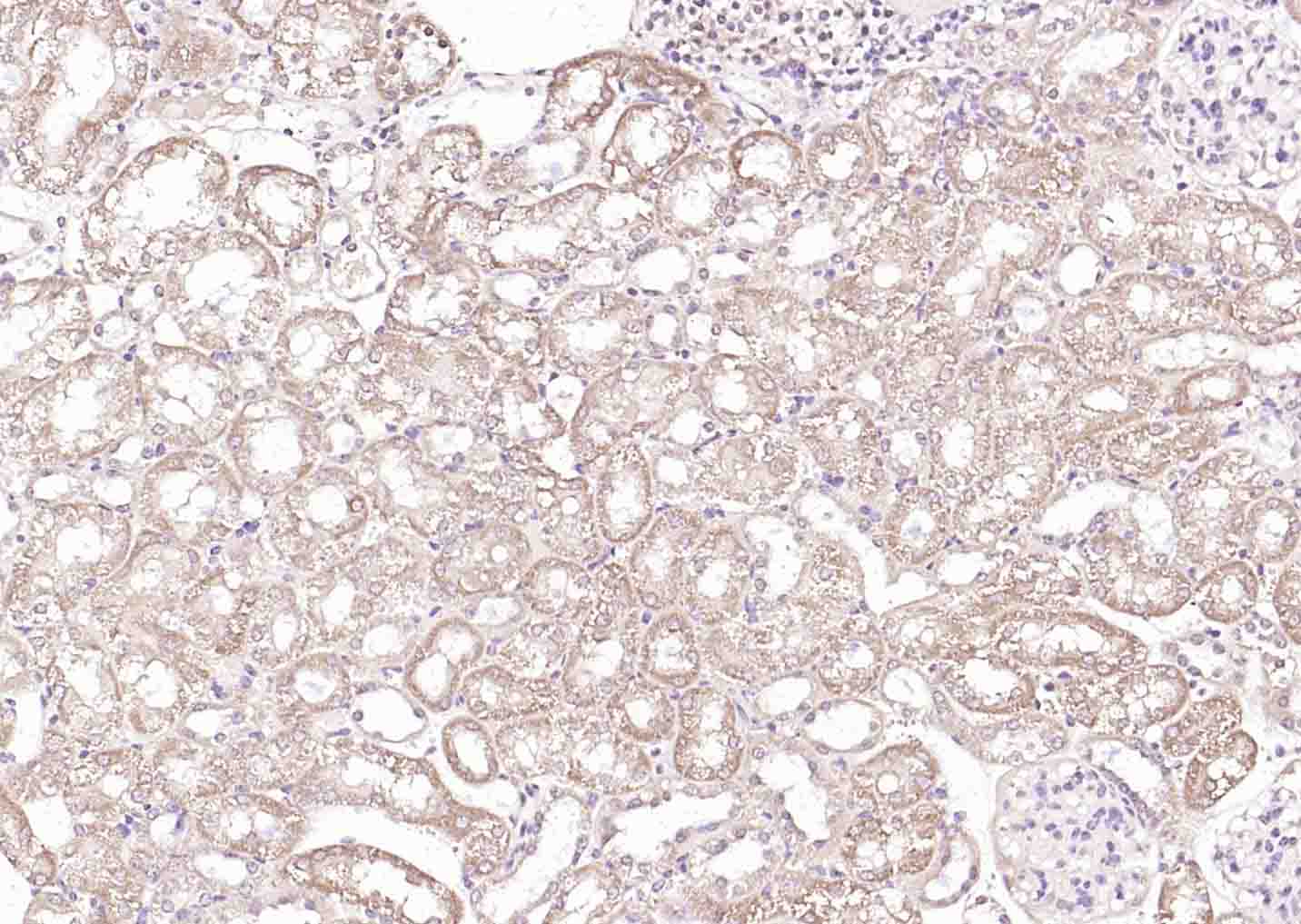 phospho-PRKD1 (Ser738) Rabbit pAb (一抗) | Bioss