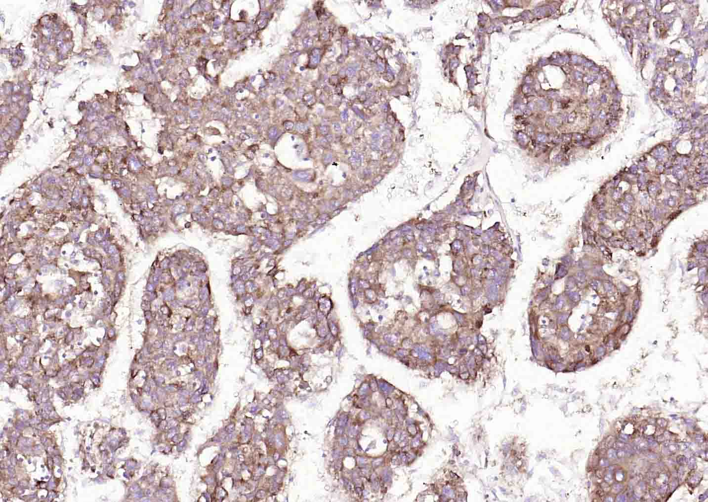 溶质载体家族蛋白39成员A14抗体-bs-19829R