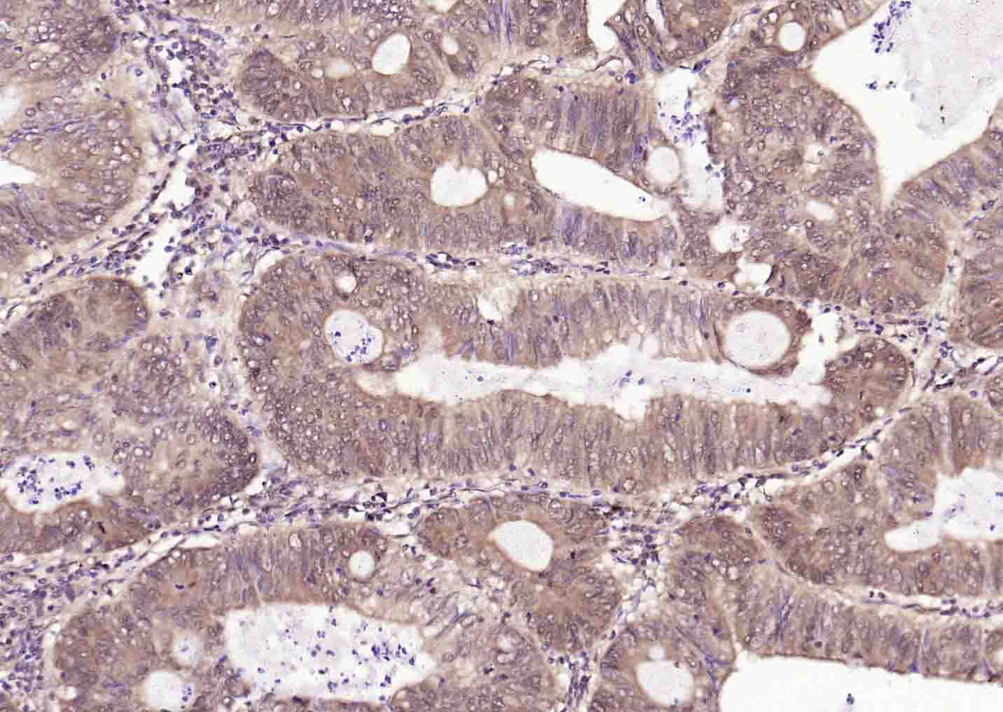 热休克蛋白71单克隆抗体-bsm-33211M