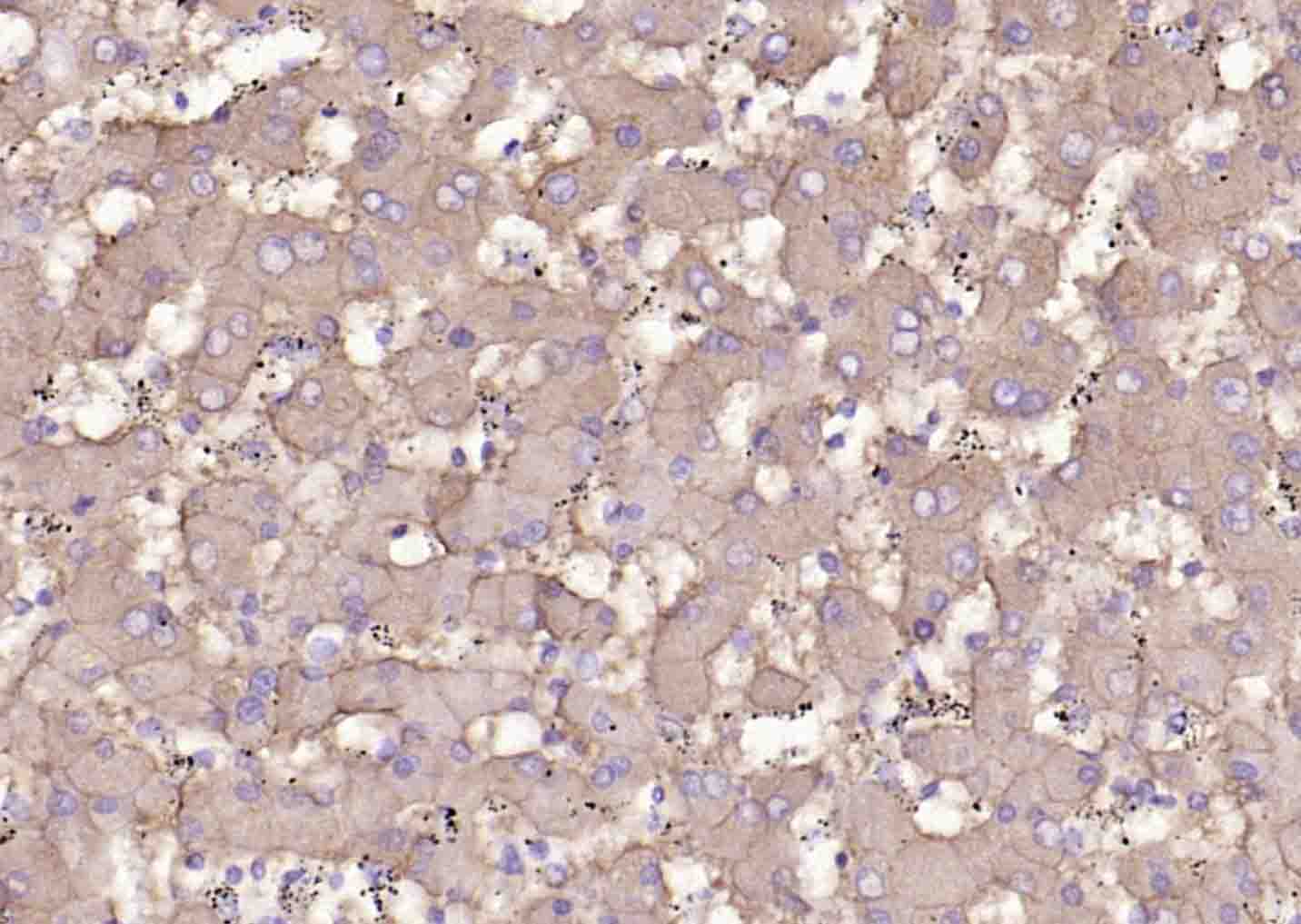 溶质载体家族蛋白39成员A14抗体-bs-19829R