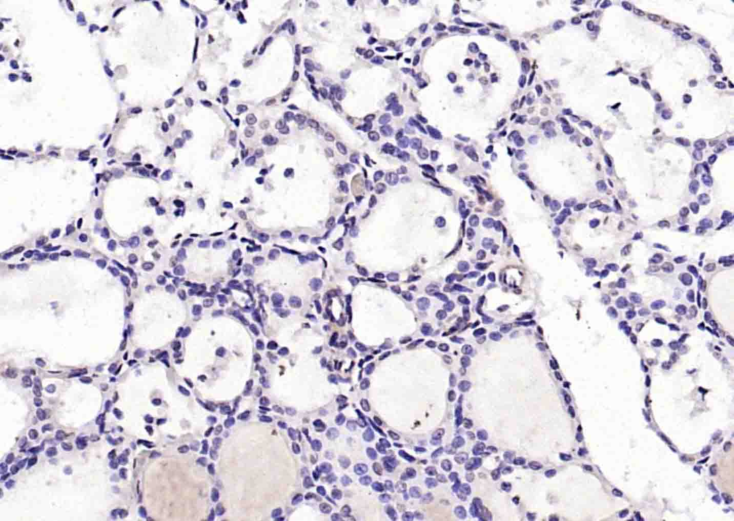 磷酸化凋亡相关蛋白4抗体-bs-12594R
