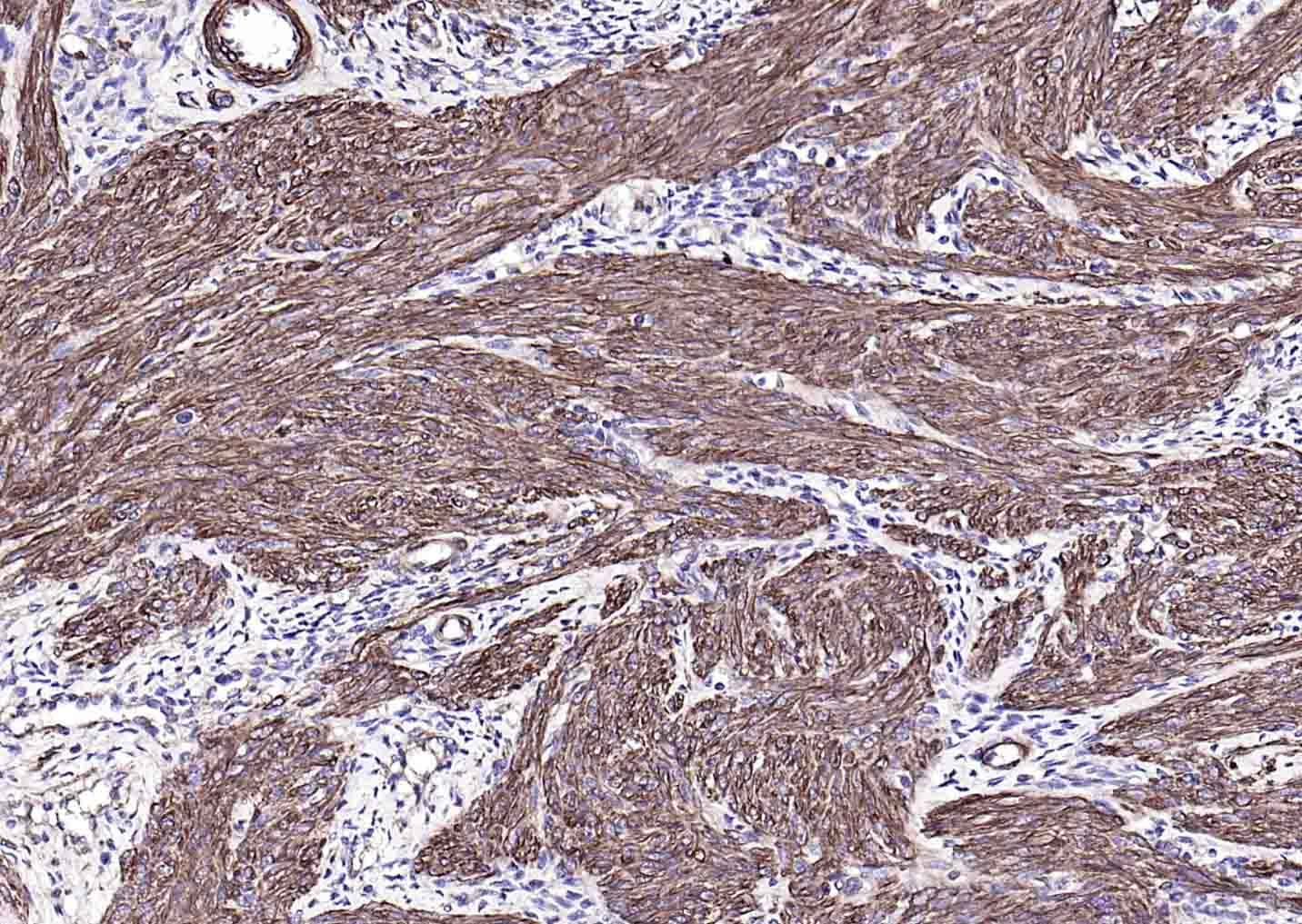 辣根过氧化物酶标记的羊抗小鼠IgG H&L