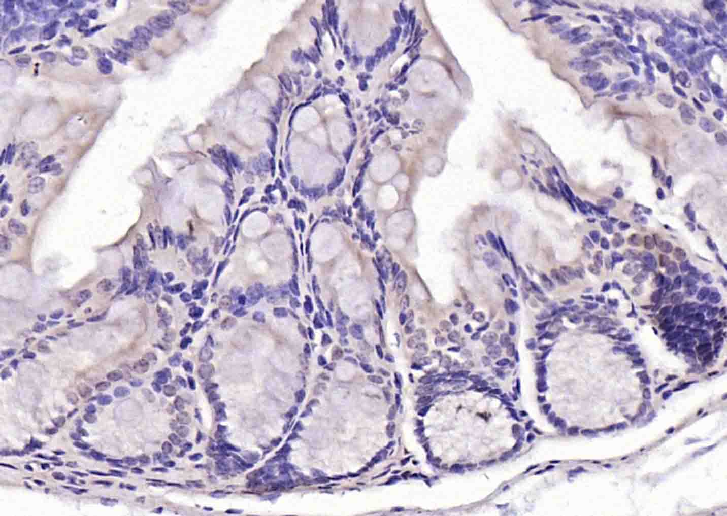 磷酸化凋亡相关蛋白4抗体-bs-12594R