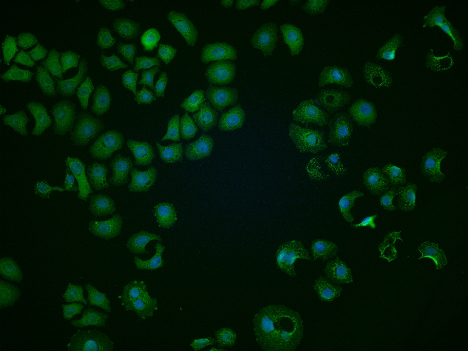 phospho-PDPK1 (Ser393) Rabbit pAb (一抗) | Bioss