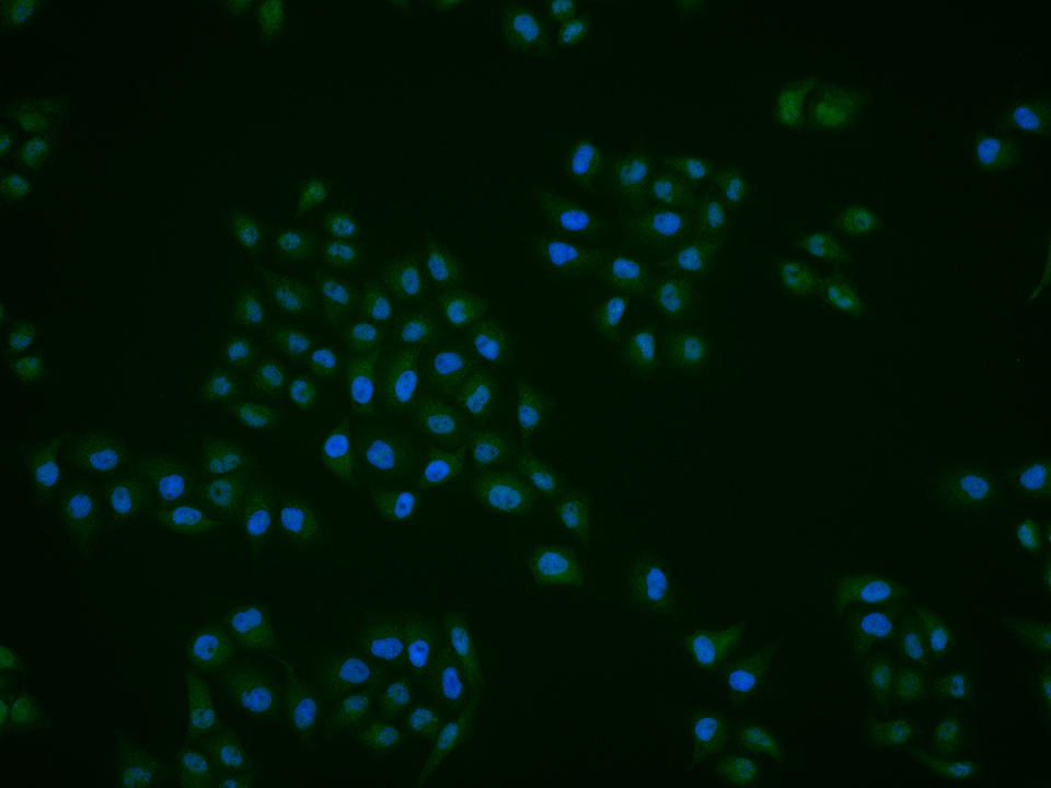 丝氨酸/苏氨酸蛋白磷酸酶1调节亚基10抗体-bs-11666R