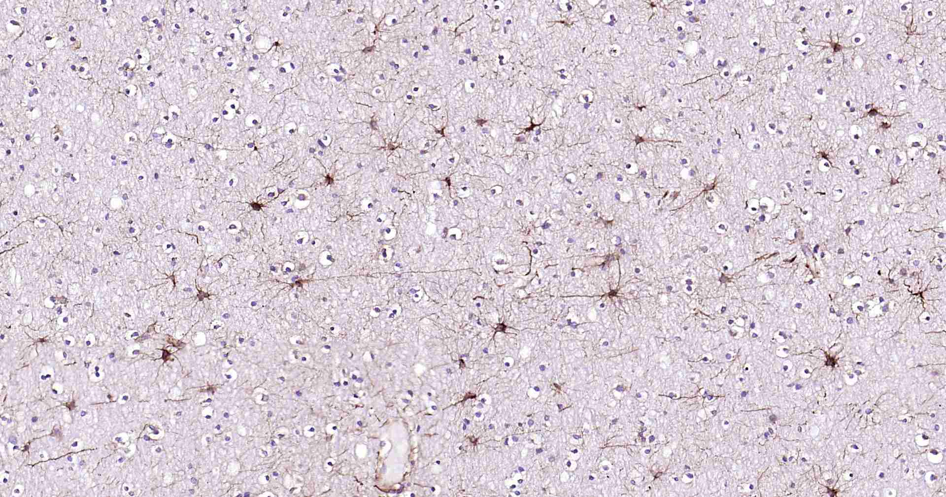 超敏二步法免疫组化检测试剂盒(兔鼠通用,即用型)