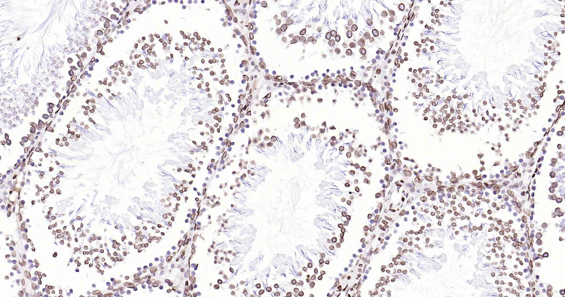 超敏二步法免疫组化检测试剂盒(小鼠,即用型)