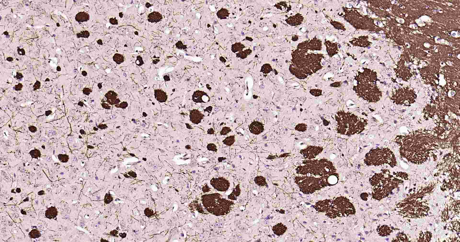 超敏二步法免疫组化检测试剂盒（兔，即用型）
