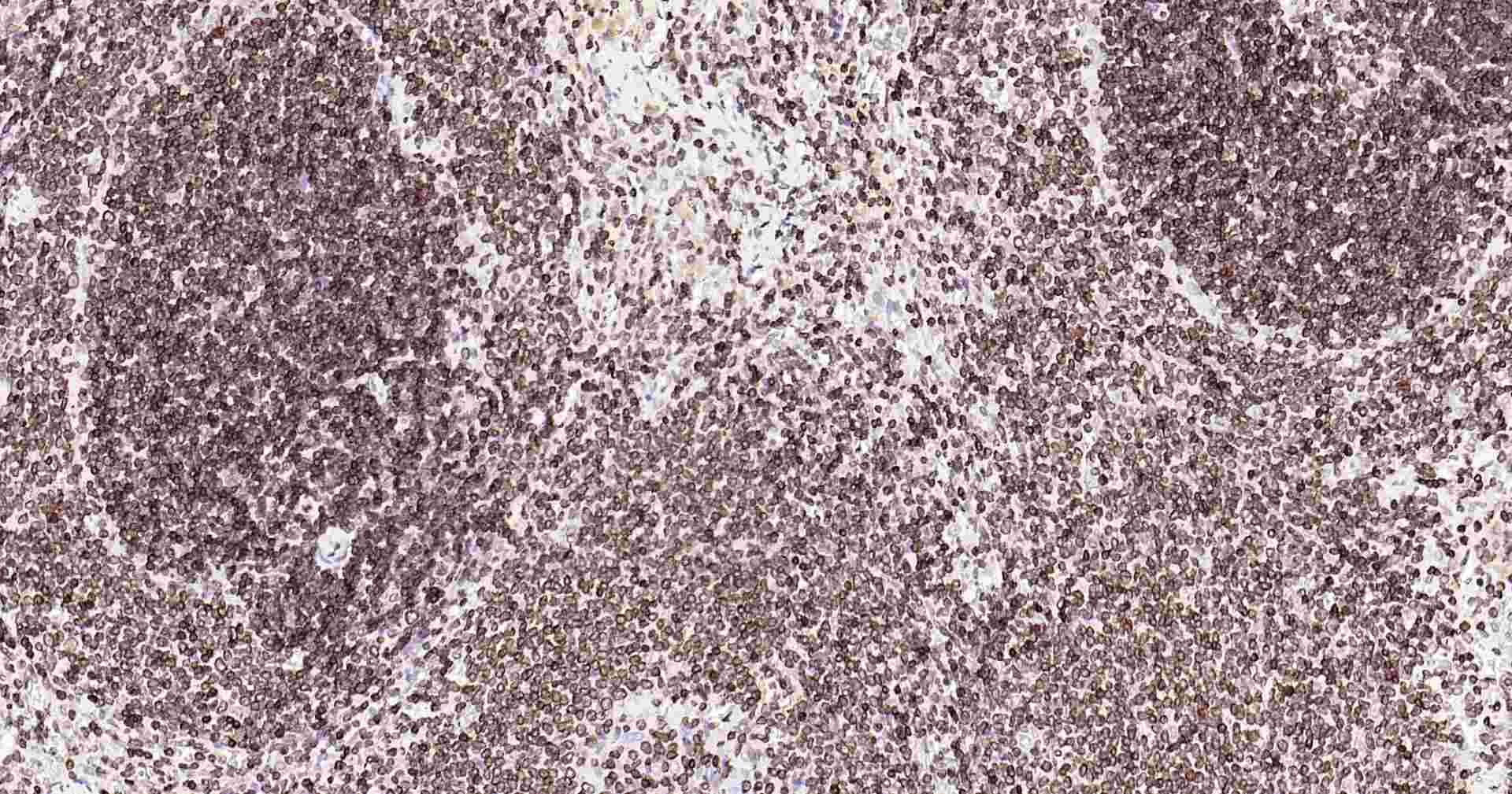 超敏二步法免疫组化检测试剂盒(小鼠,即用型)