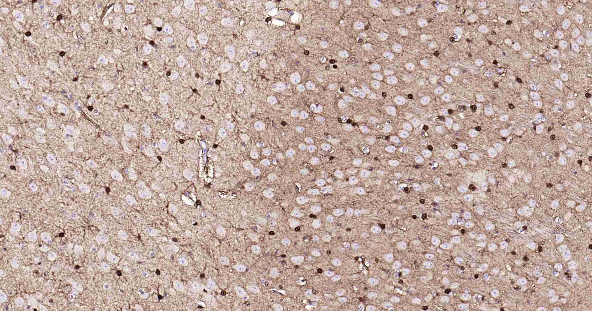 超敏二步法免疫组化检测试剂盒(小鼠,即用型)