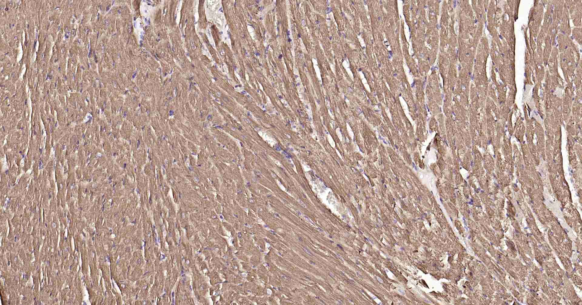 超敏二步法免疫组化检测试剂盒（兔，即用型）