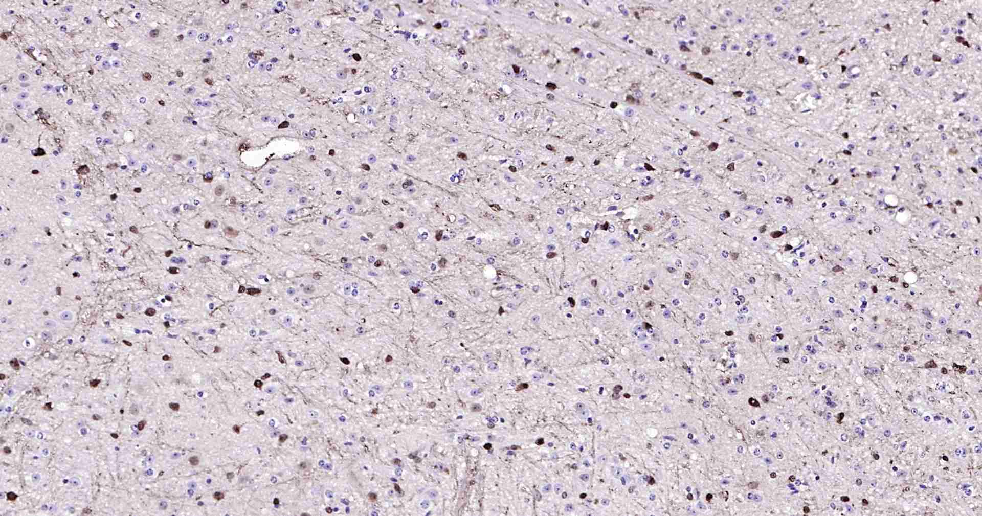 超敏二步法免疫组化检测试剂盒(兔鼠通用,即用型)