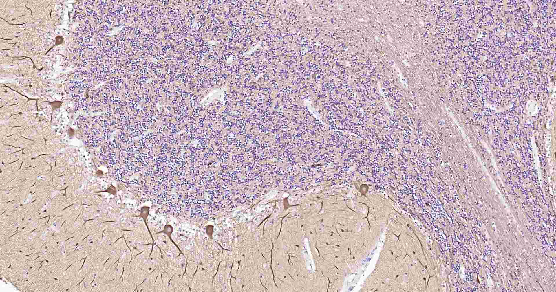 超敏二步法免疫组化检测试剂盒(小鼠,即用型)