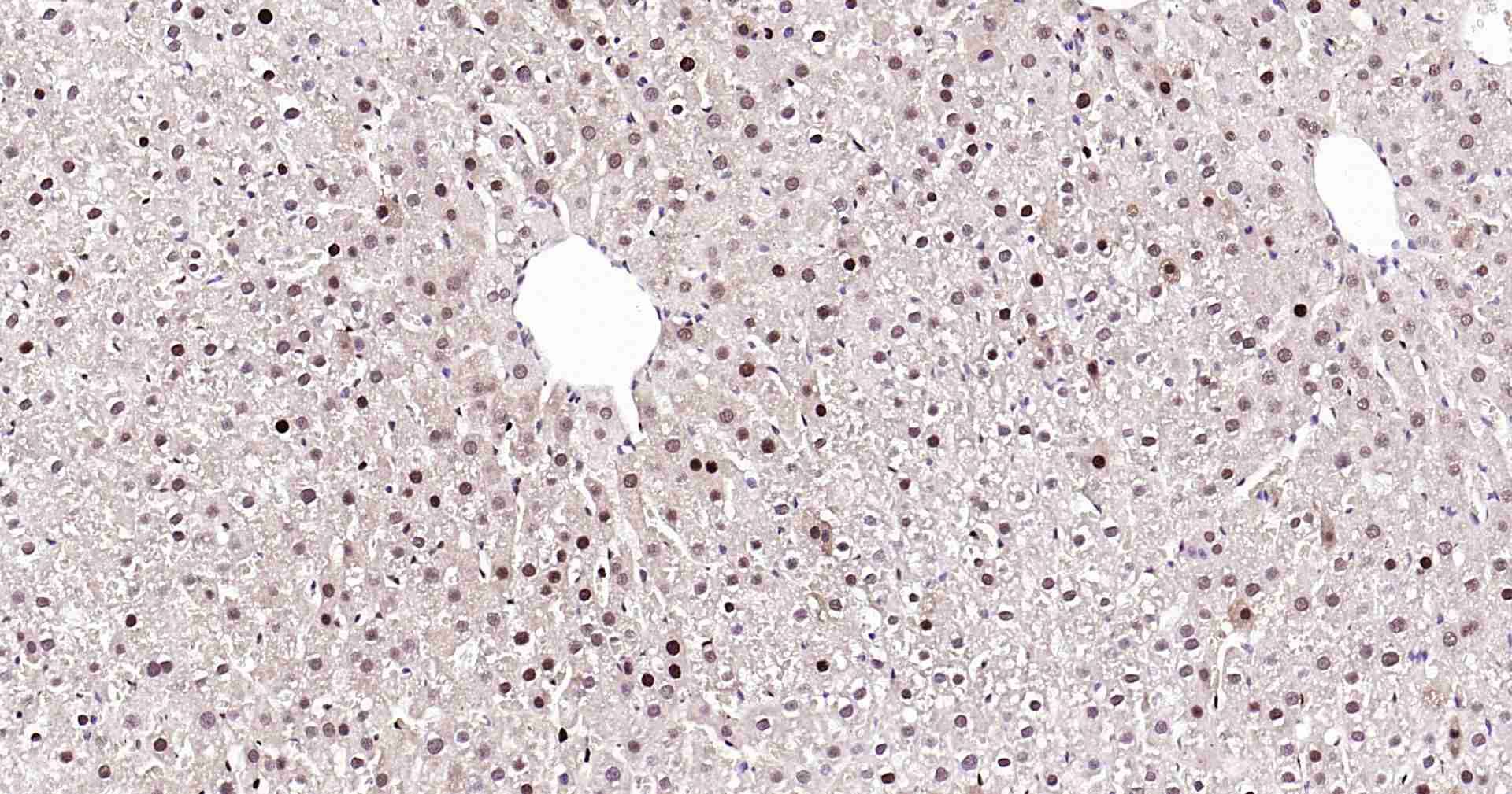 超敏二步法免疫组化检测试剂盒(兔鼠通用,即用型)