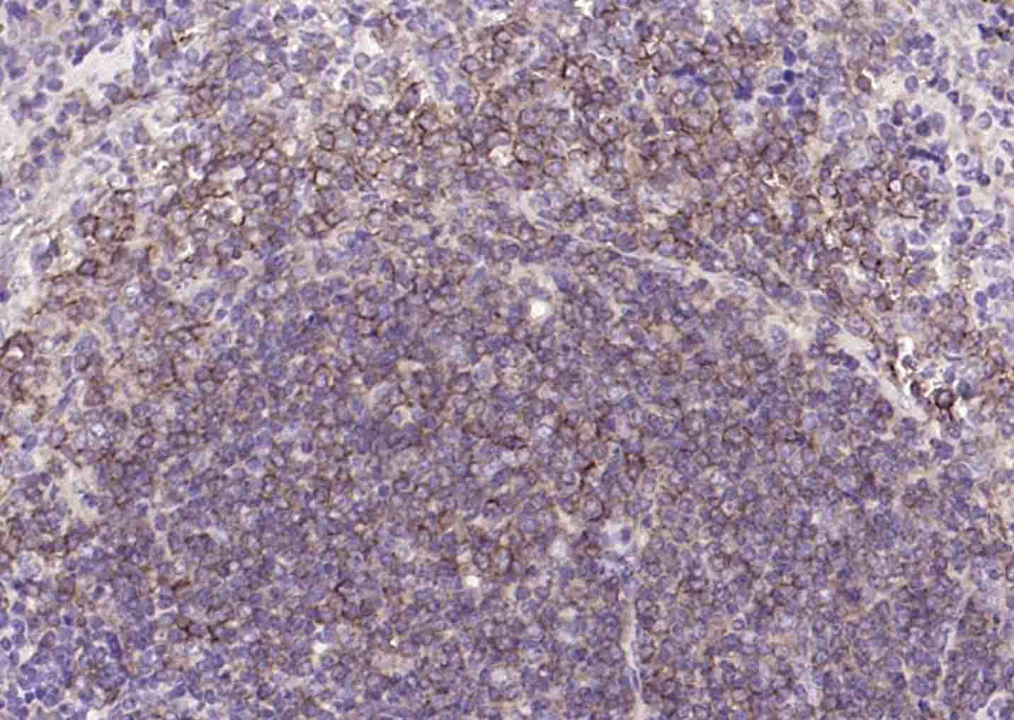 CD19 Rabbit pAb (一抗) - IHC-P,IHC-F,IF | Bioss