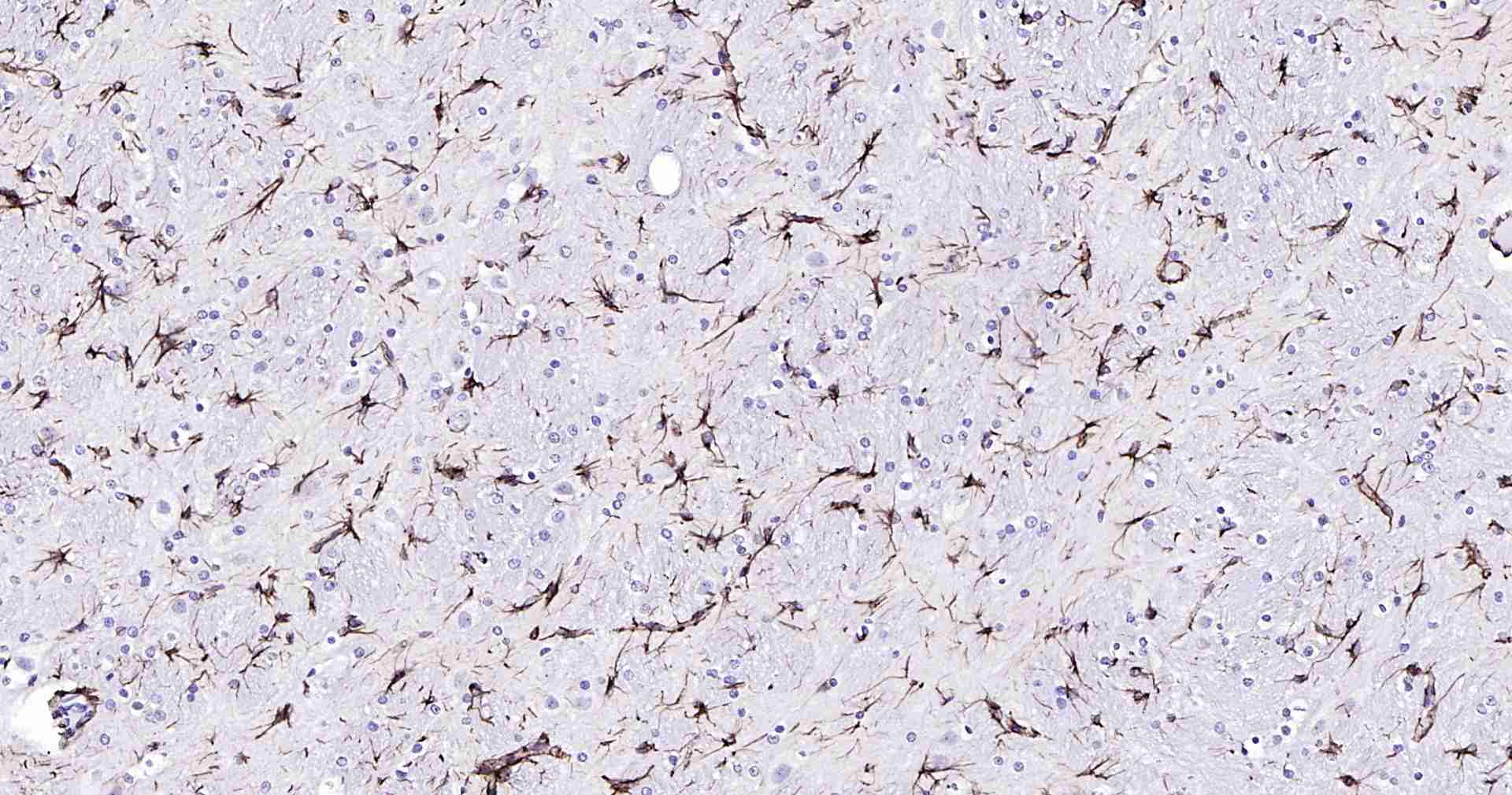 超敏二步法免疫组化检测试剂盒(兔鼠通用,即用型)