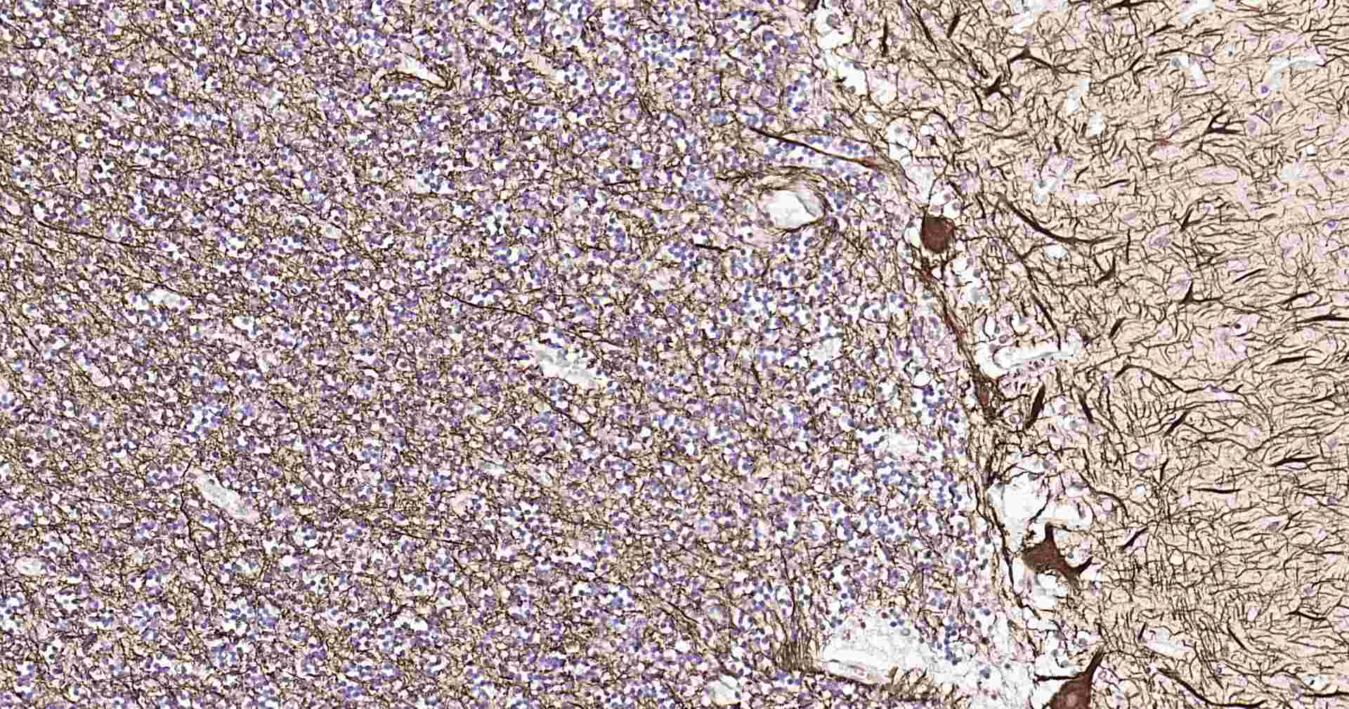 超敏二步法免疫组化检测试剂盒（兔，即用型）