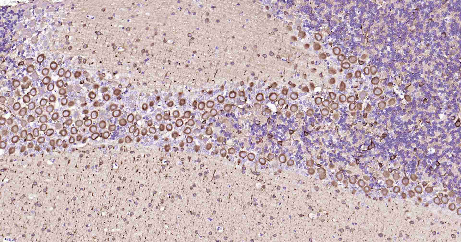 超敏二步法免疫组化检测试剂盒(小鼠,即用型)