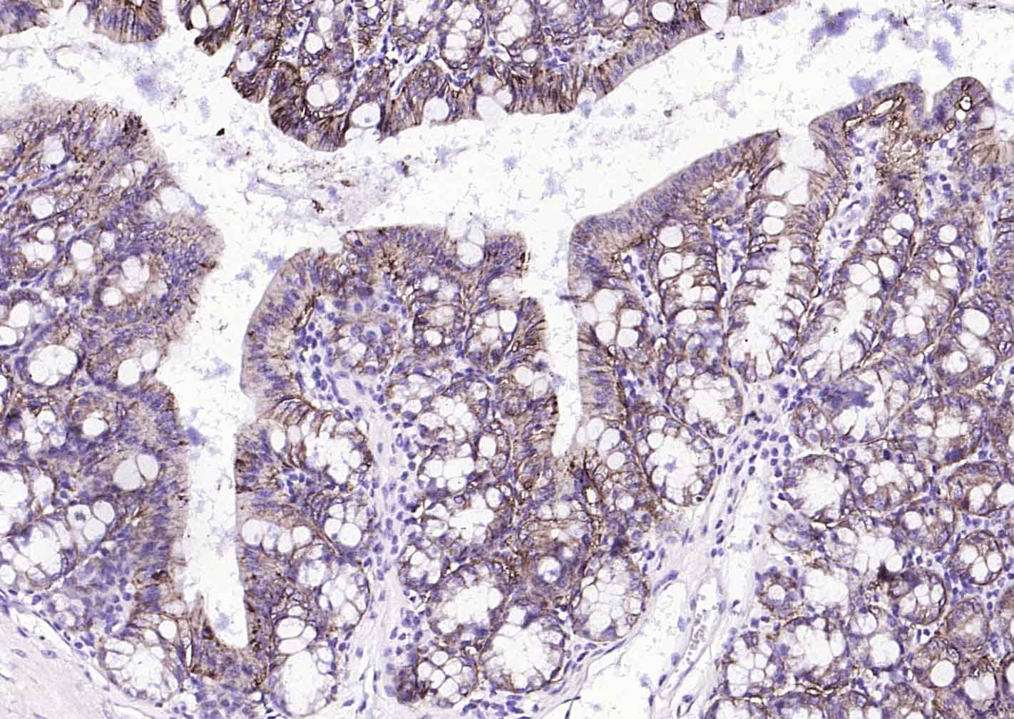 上皮细胞粘附分子（CD326）重组兔单抗