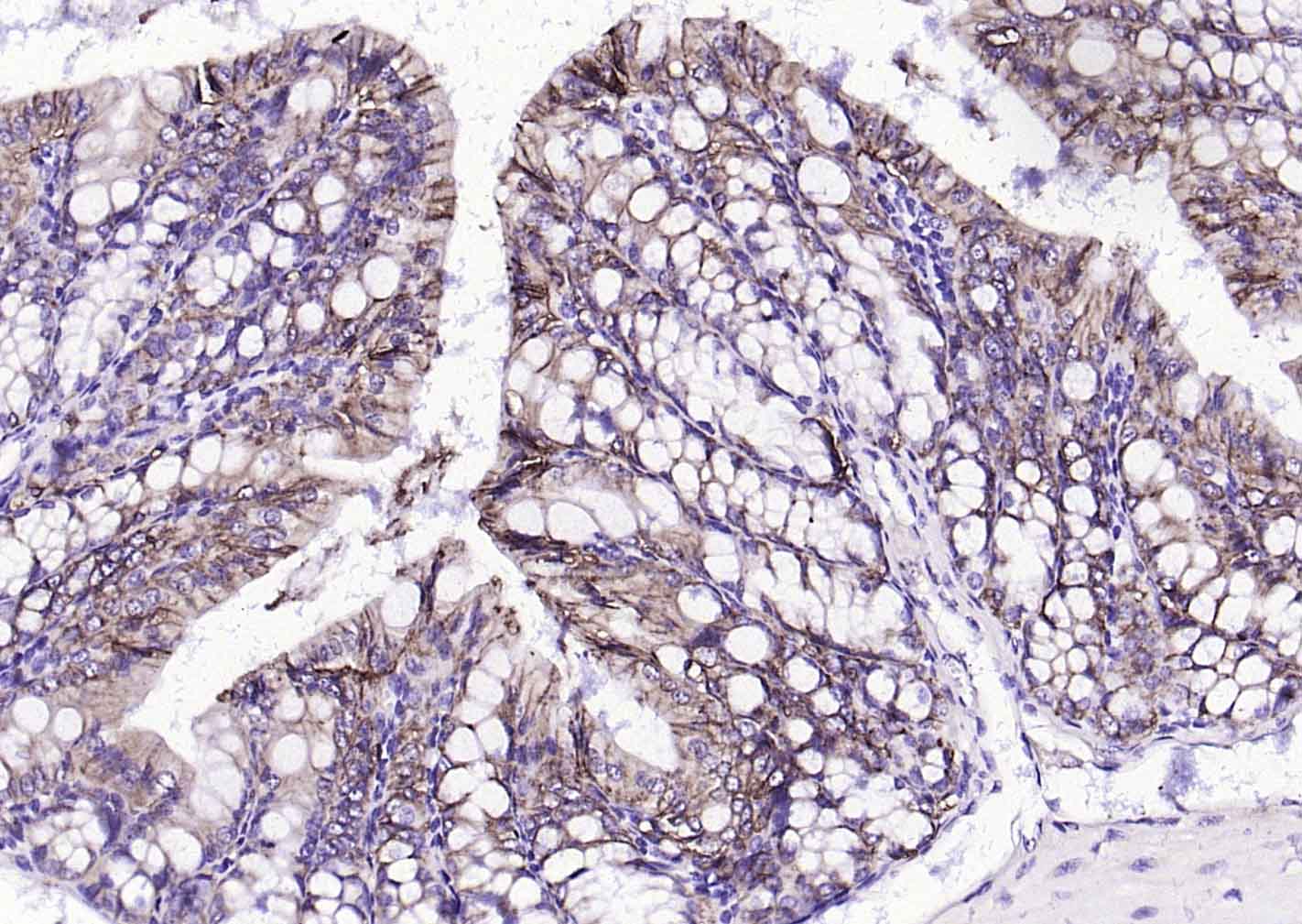 上皮细胞粘附分子（CD326）重组兔单抗
