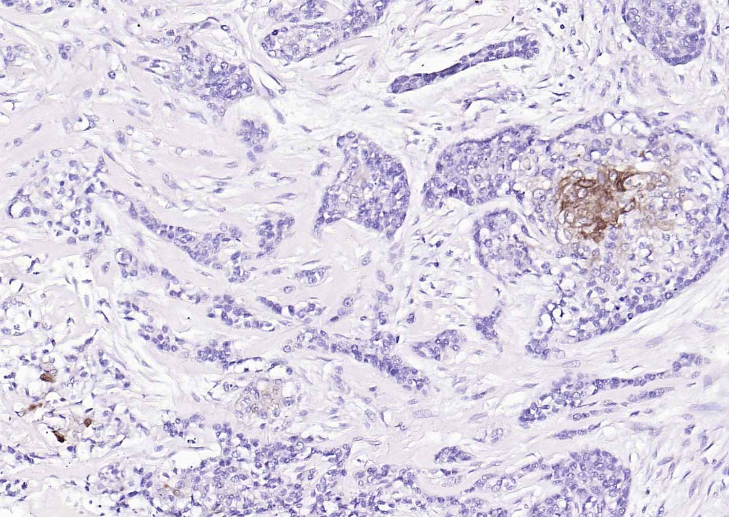 乙醛脱氢酶1型重组兔单抗