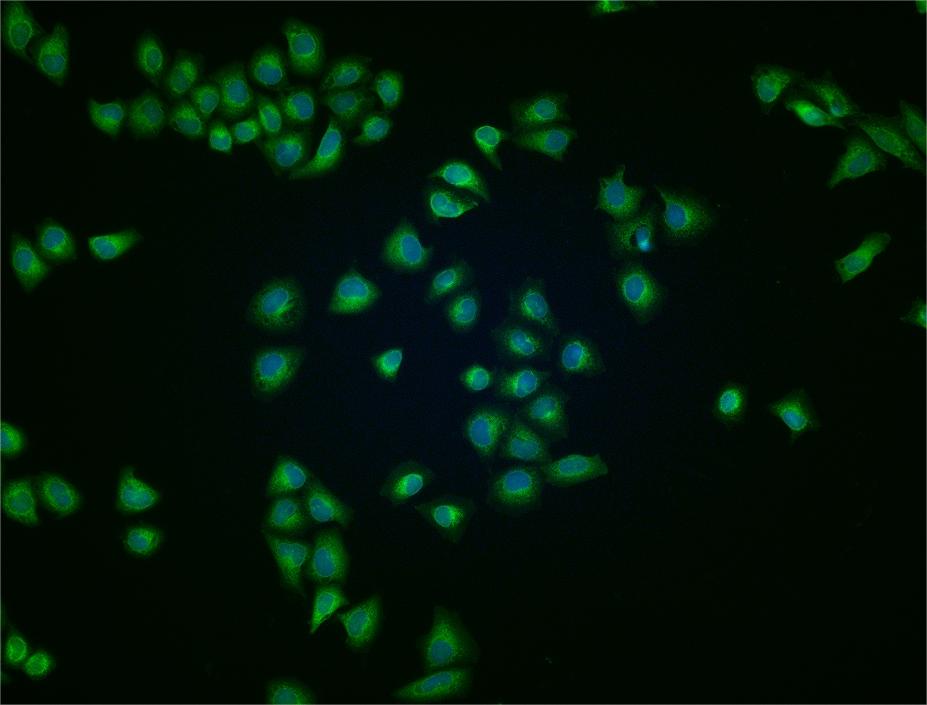 网格蛋白重链抗体-bs-2932R