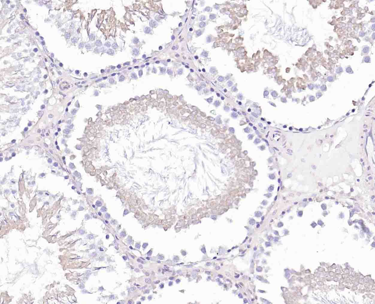 Rho鸟苷酸交换因子2重组兔单抗
