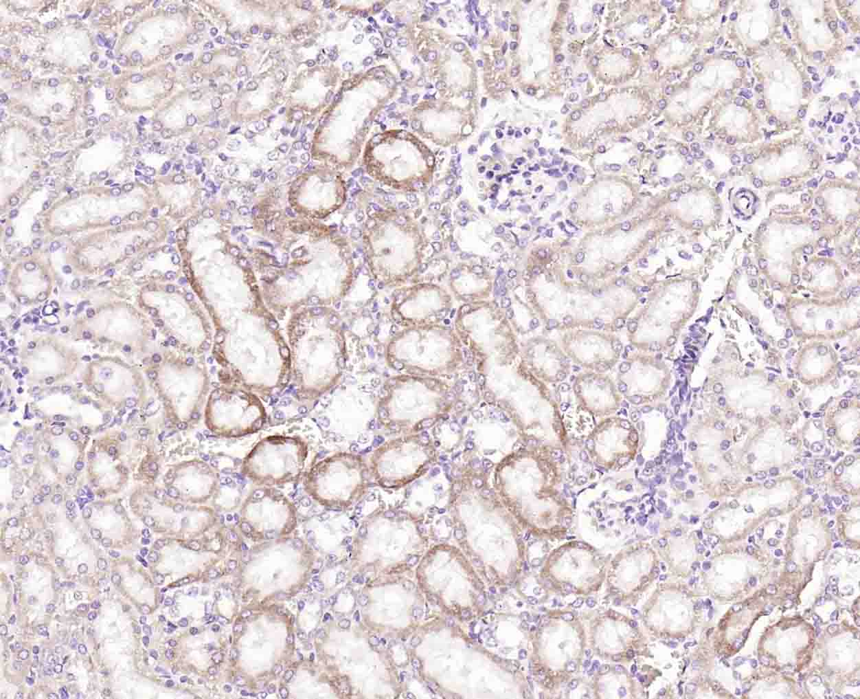 丝氨酸/苏氨酸蛋白激酶MARK2重组兔单抗