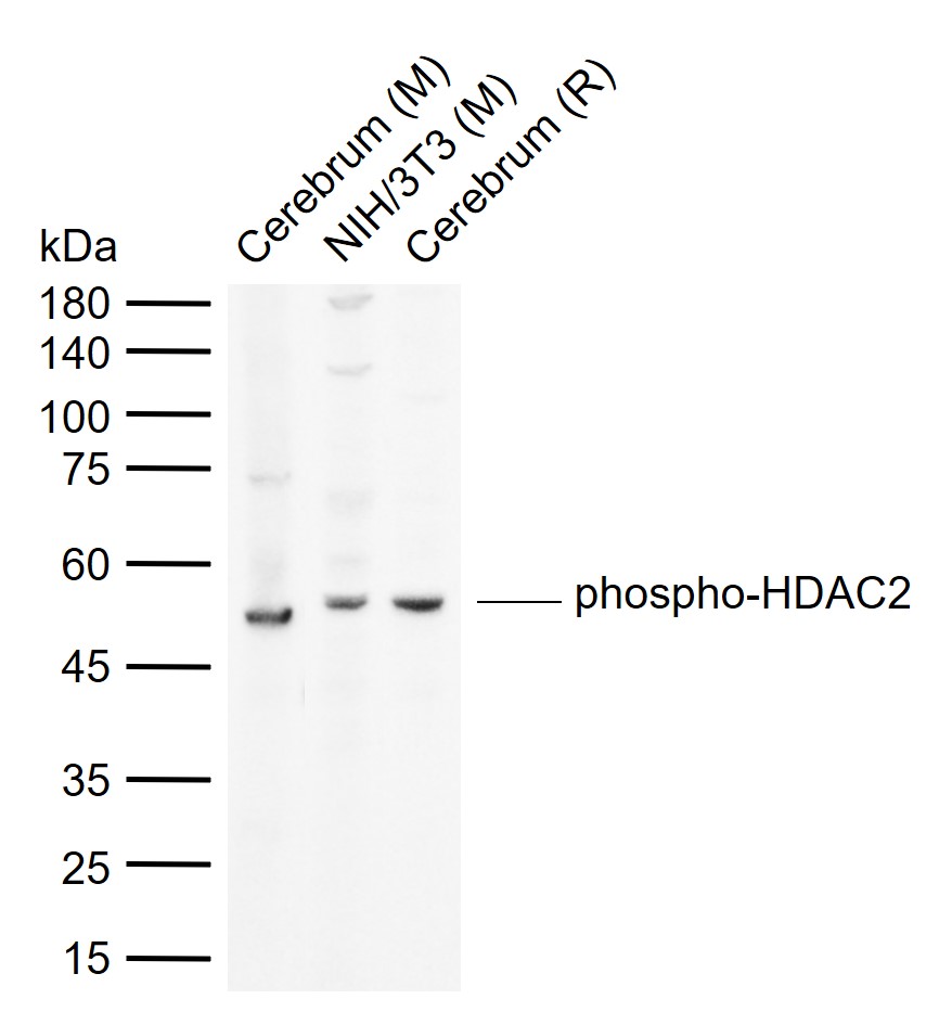 phospho-HDAC2 (Ser394) Rabbit pAb (一抗) | Bioss