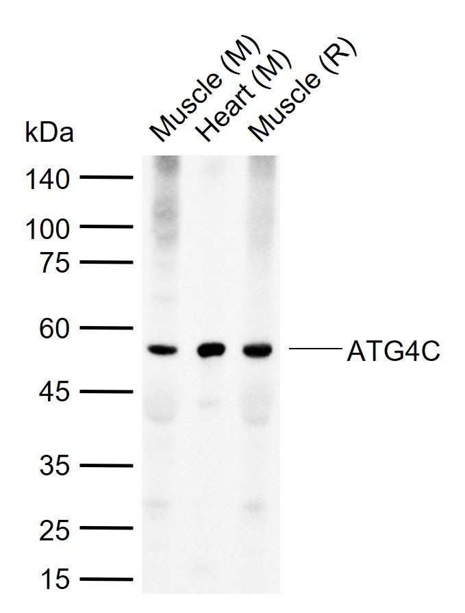 自噬相关蛋白4C抗体-bs-4008R