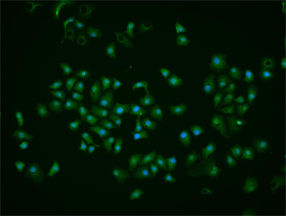 热休克因子1抗体-bs-3757R