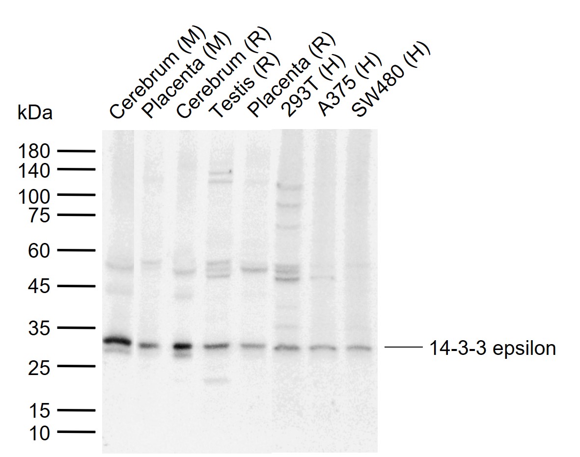 14-3-3 epsilon Rabbit pAb (一抗) | Bioss
