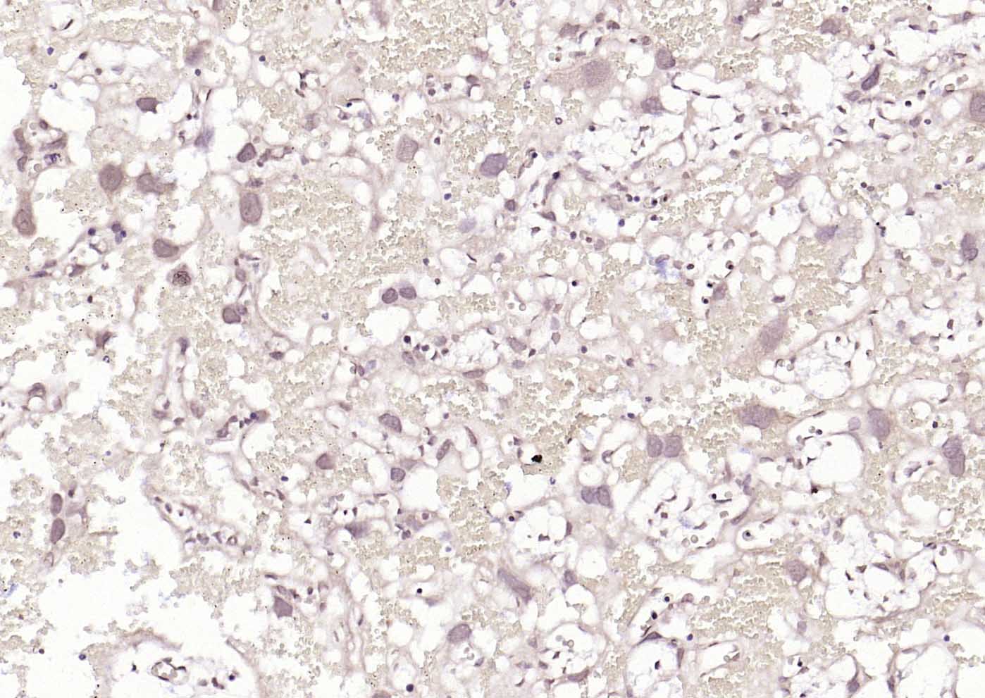 热休克因子1抗体-bs-3757R