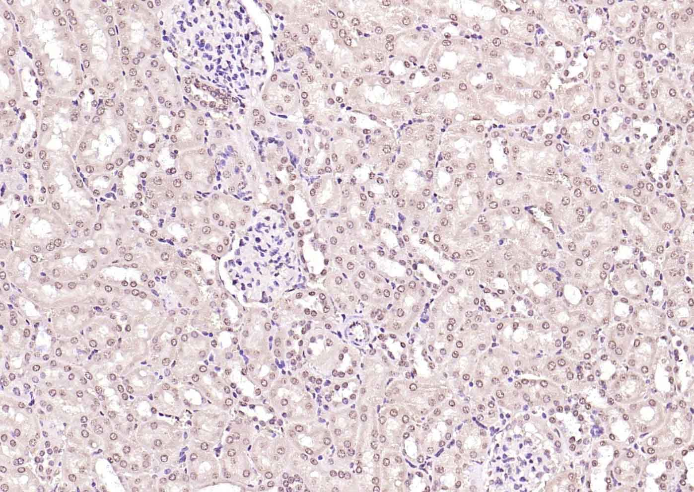 热休克因子1抗体-bs-3757R