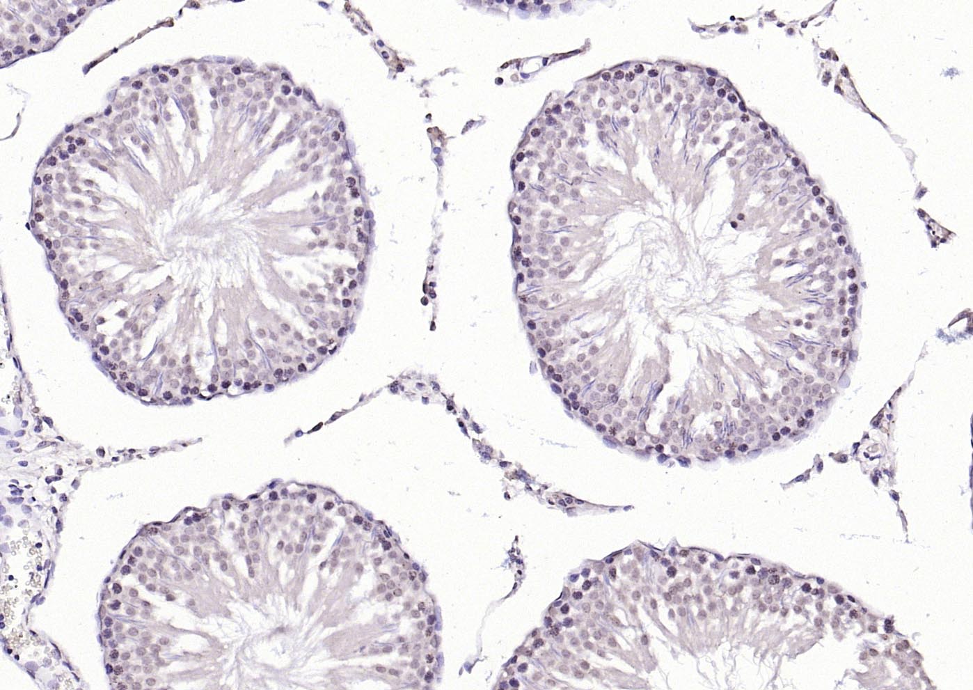 热休克因子1抗体-bs-3757R