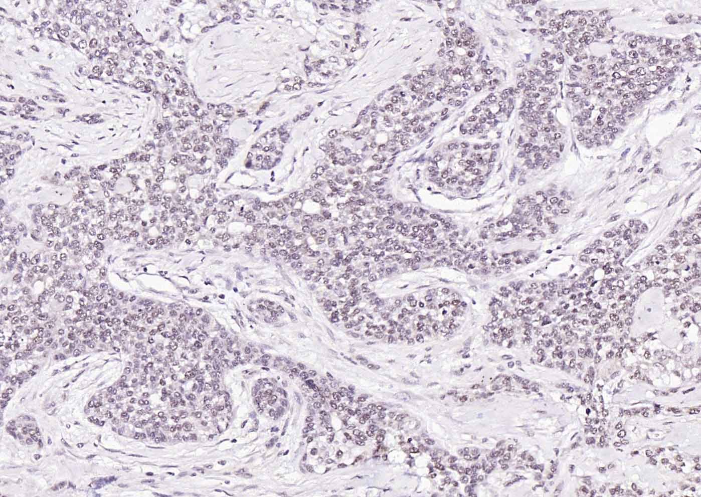 热休克因子1抗体-bs-3757R